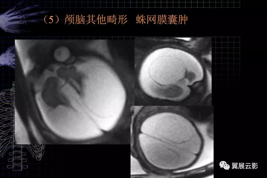 胎兒磁共振解剖圖譜