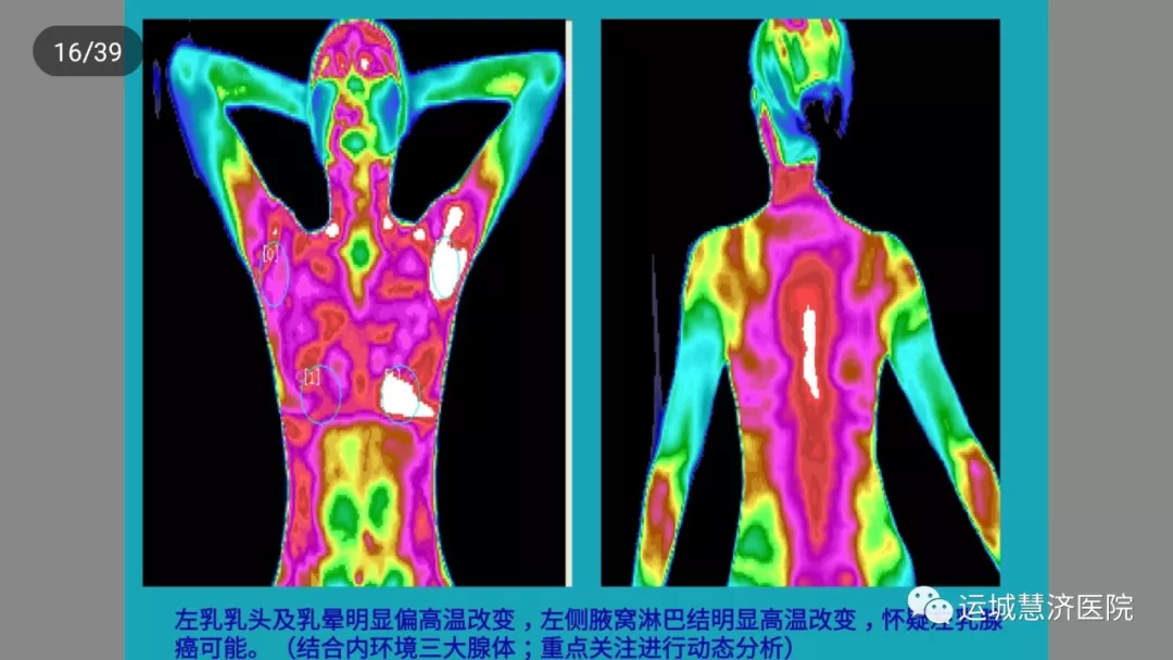 人体透视镜红外线图片