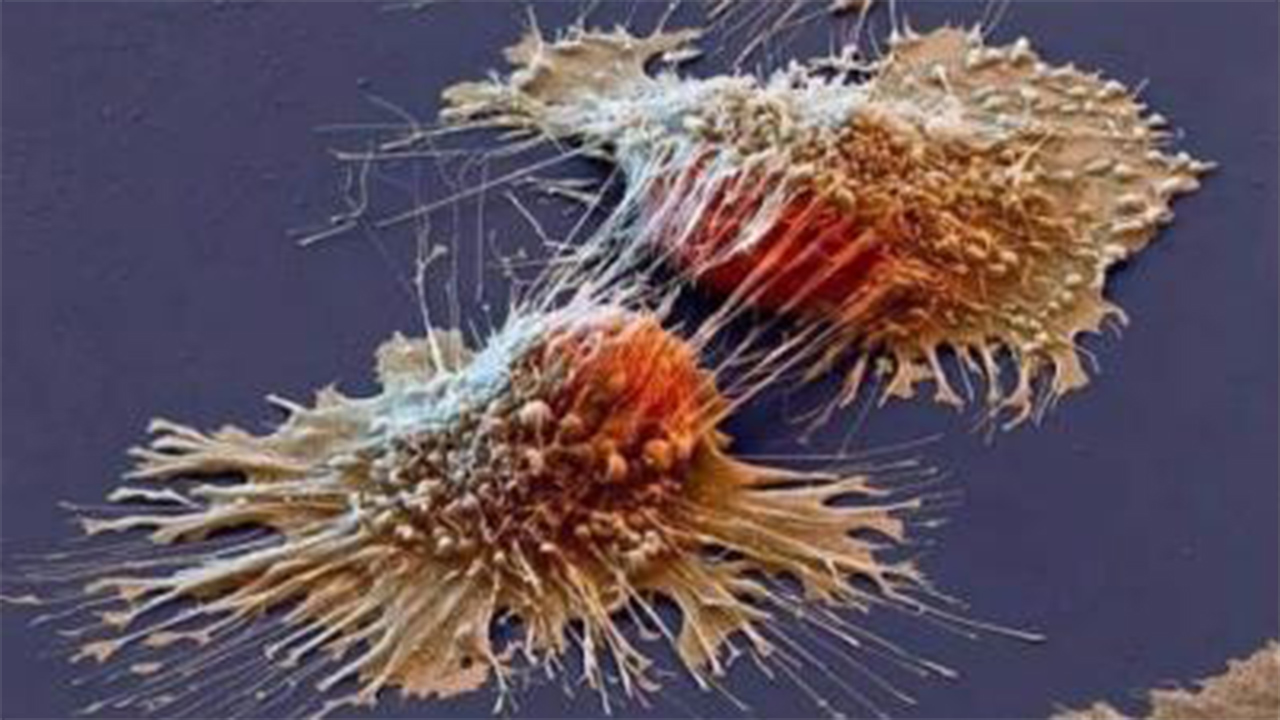 在显微镜下癌细胞是怎样吞噬正常细胞的?看完大开眼界