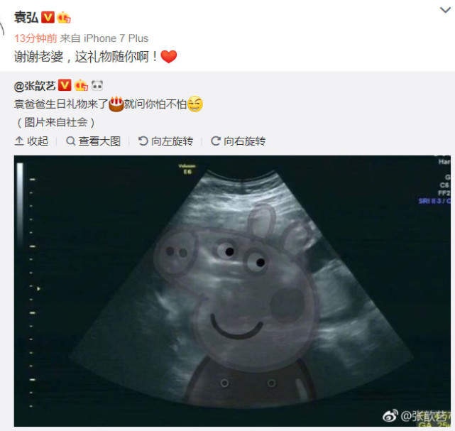 37岁的张歆艺晒b超照宣布怀孕,袁弘喜当爹!