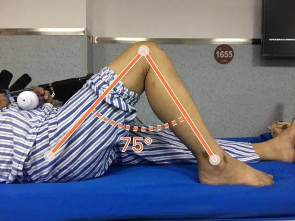 膝关节屈曲角度图片