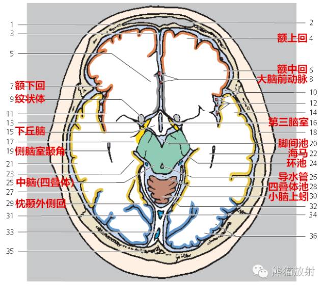 颅脑CT层面分层图片