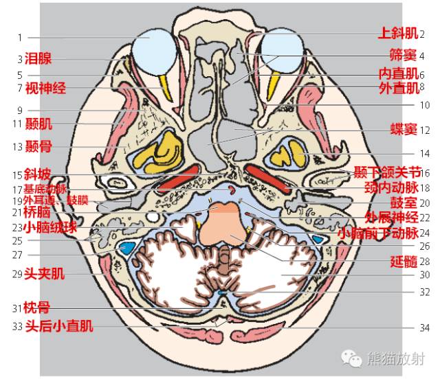 解剖入门颅脑ct断层中英文对照