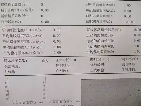 流行性腮腺炎竟是引起男性无精不育的导火索