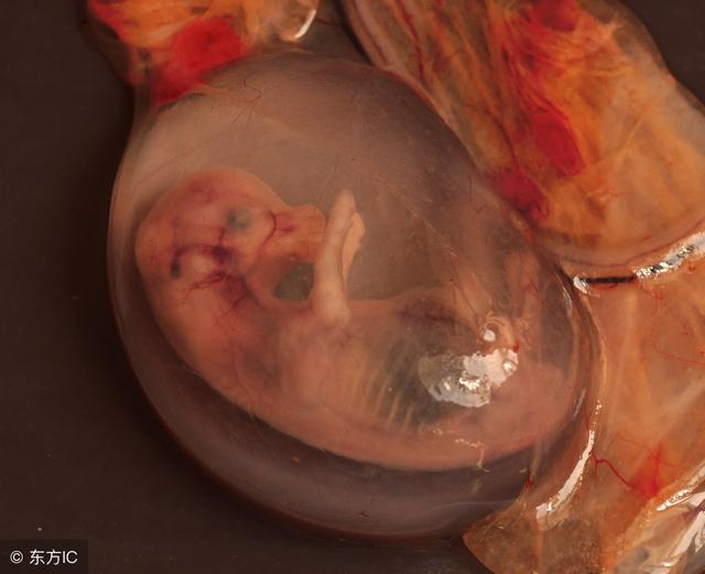 70天的胎儿流产图片图片