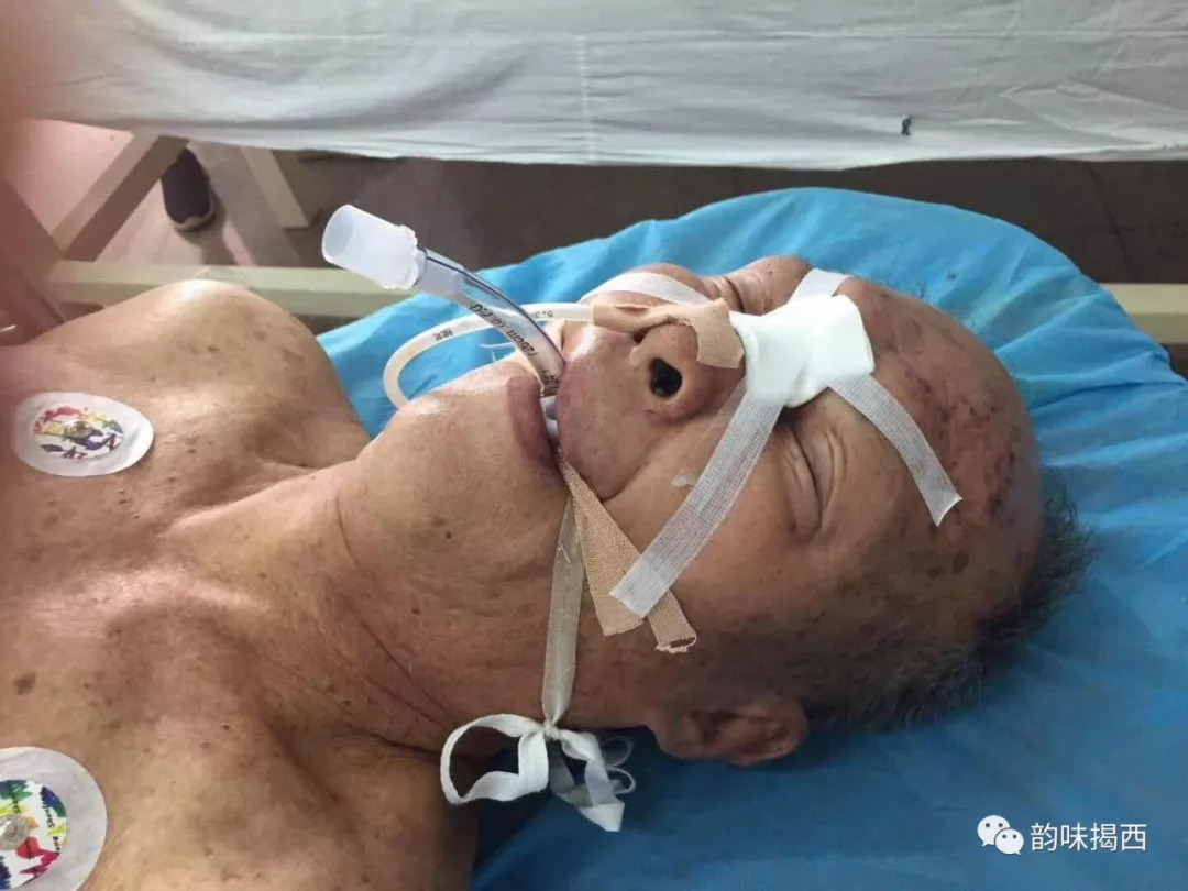 一个约80岁的老人深度昏迷,医院急寻患者家属