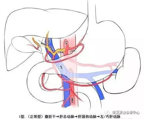 影像解剖肝動脈系統變異分型