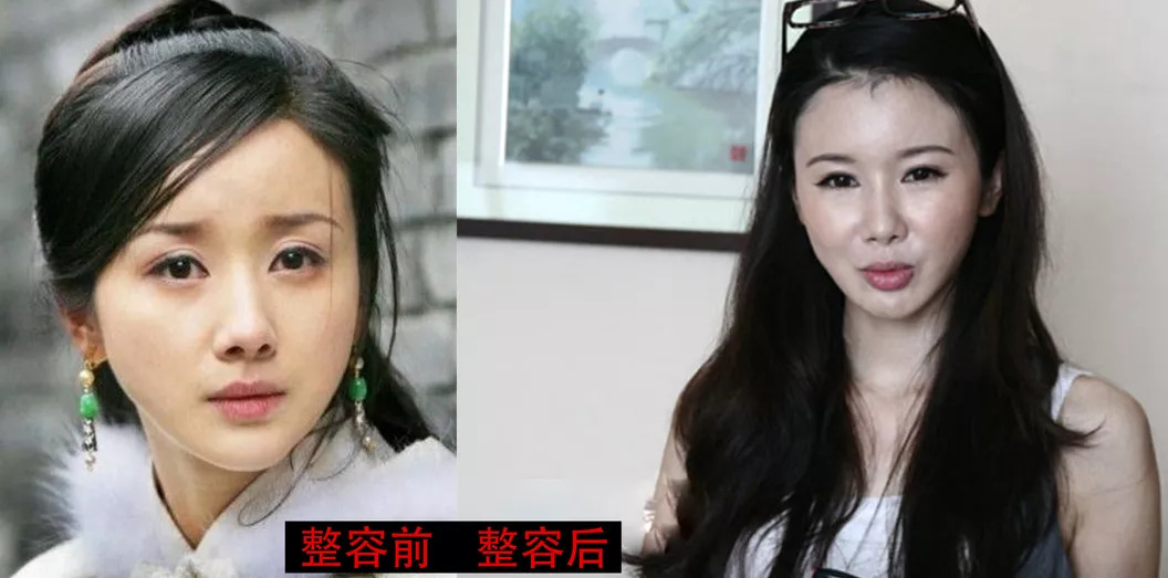 姐例举两个整容失败的反例:不过娱乐圈的美女那么多,明星们难免会想到