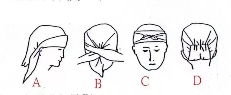 三角巾帽式包扎法图片