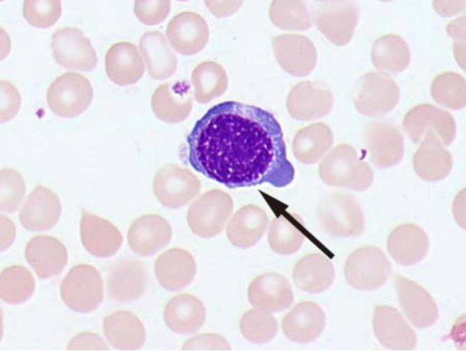 中幼红细胞10▼答案:中性中幼粒细胞下期我们一起看淋巴细胞~回 