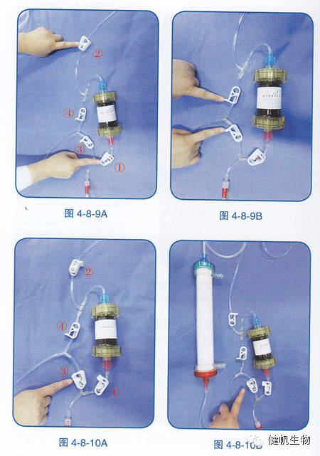 血液灌流器连接图图片