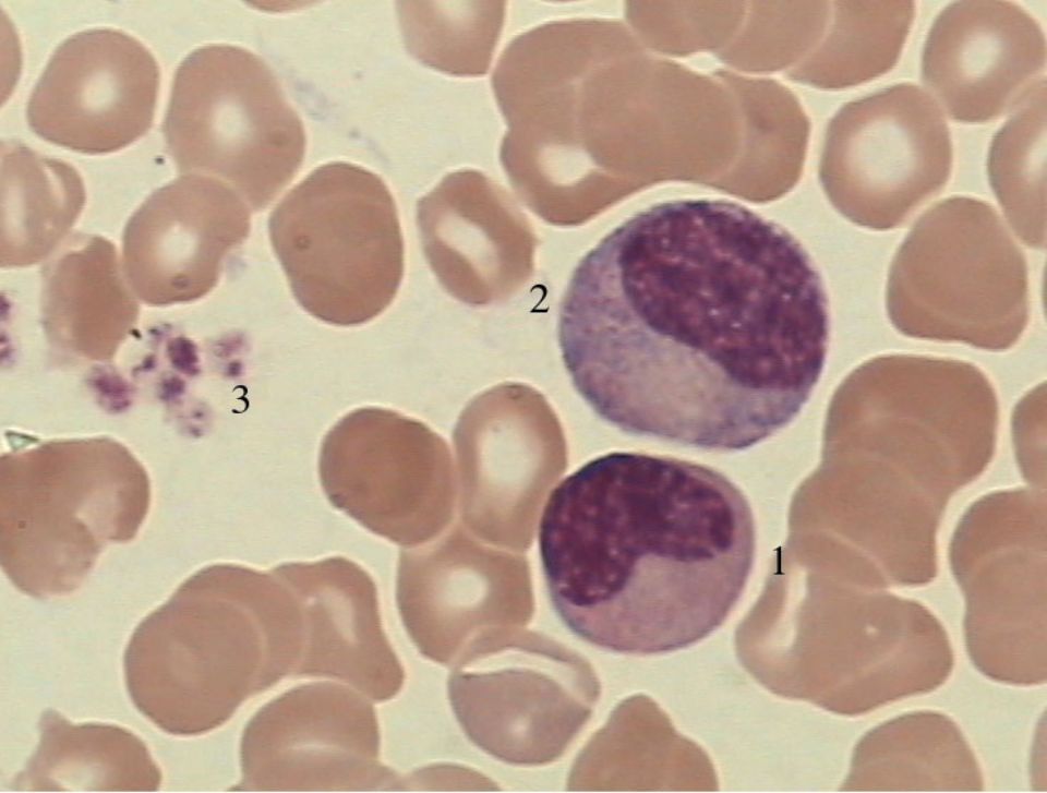 中性粒细胞镜下图片