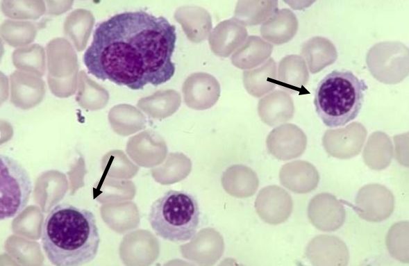 ▼答案:中幼红细胞10▼答案:中性中幼粒细胞下期我们一起看淋巴细胞