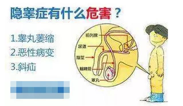 2岁宝宝先天睾丸错位医生腹腔镜下手术送它回家