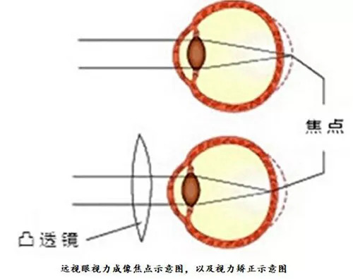 老花镜成像原理图图片