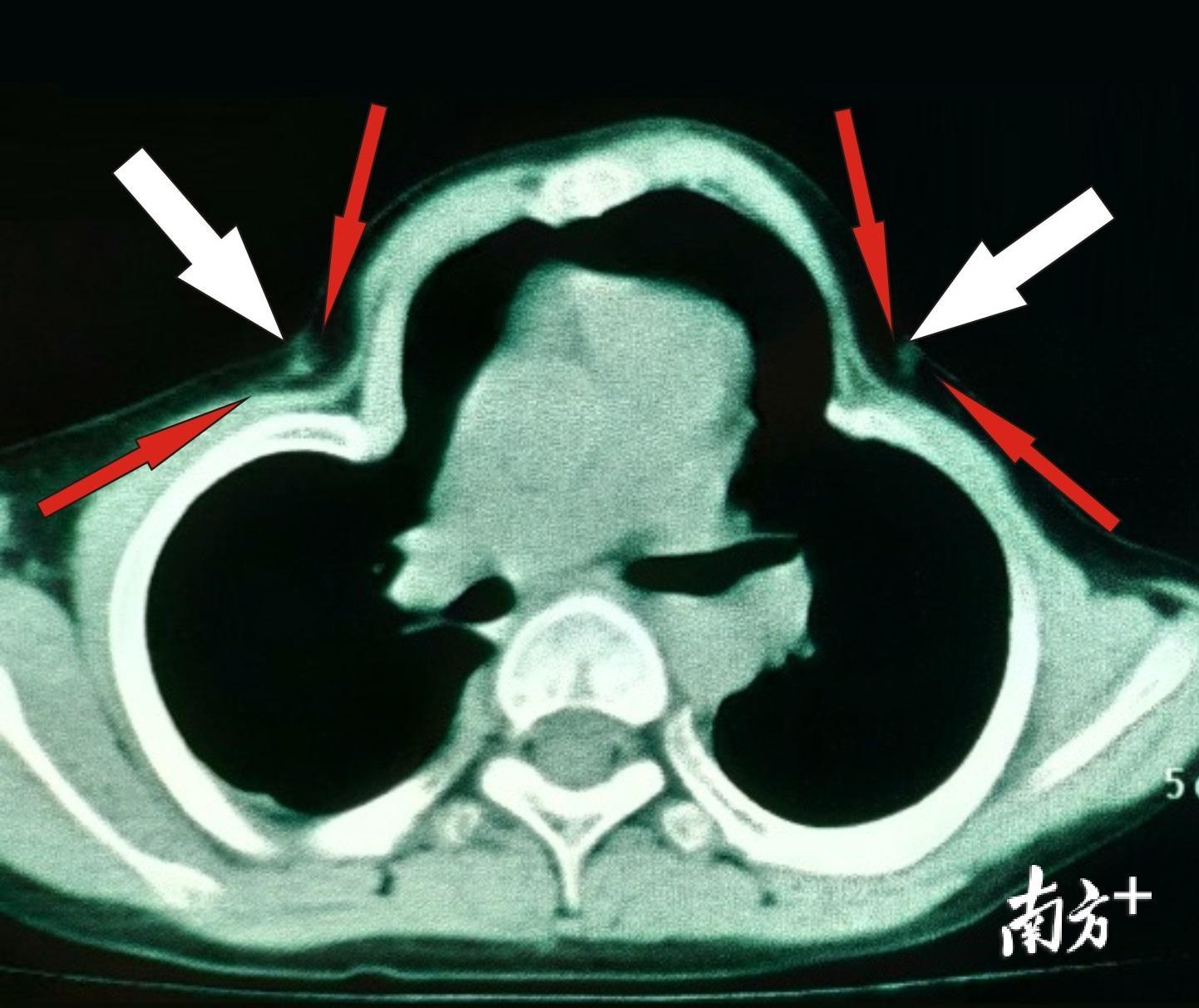 為救胸