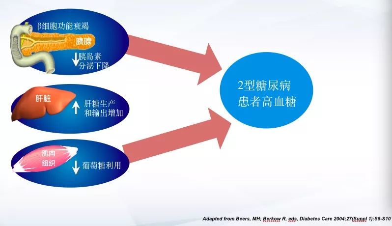 不值得骄傲的「第一:聚焦「糖尿病诊疗与用药」