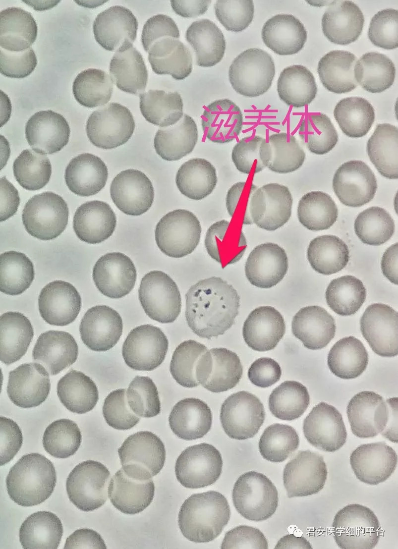 间日疟原虫小滋养体图片