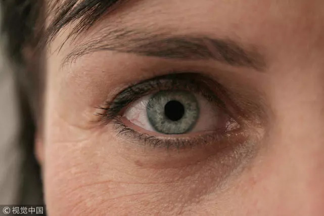 黑眼圈久久不消可能是这些疾病在作怪