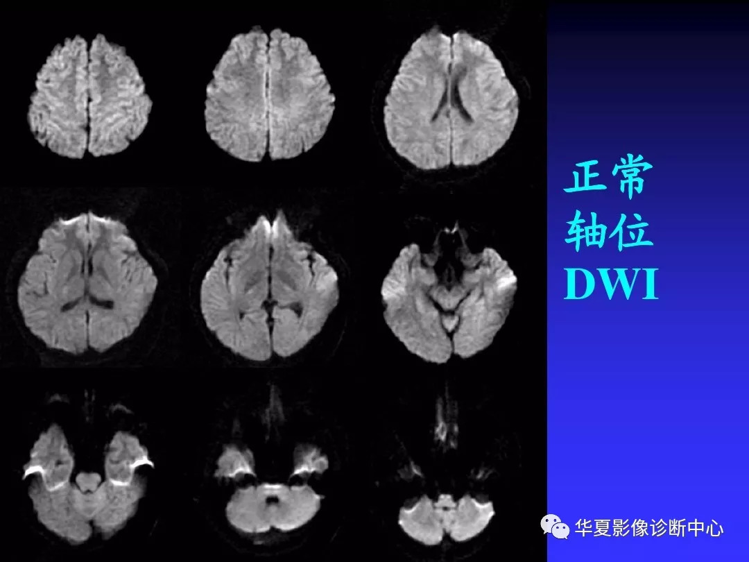 基礎必備頭顱mri讀片知識