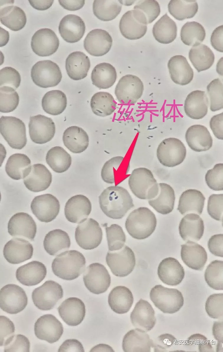 间日疟原虫滋养体图片