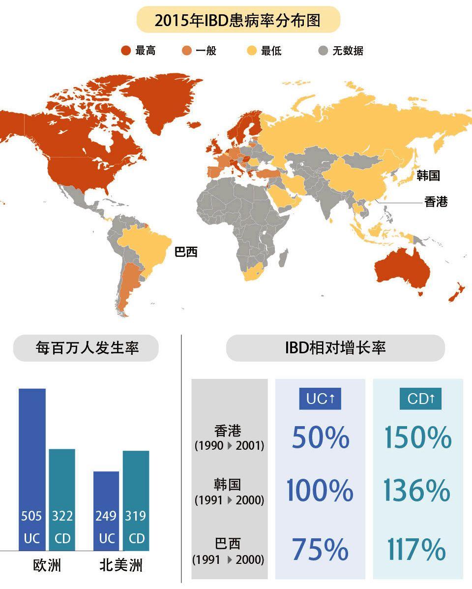 炎症性肠病发病率飙升且可能致死的新富贵病普唯尔