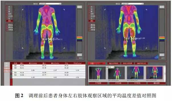 斷層成像技術(ttm)應用於患者康復調理》登入《世界中西醫雜誌》_中醫