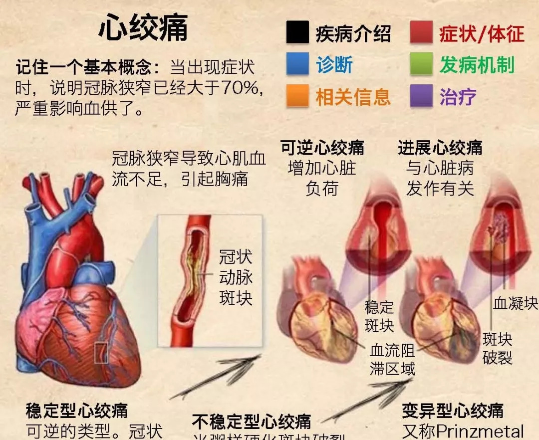 關注冠心病和心絞痛的區別是什麼