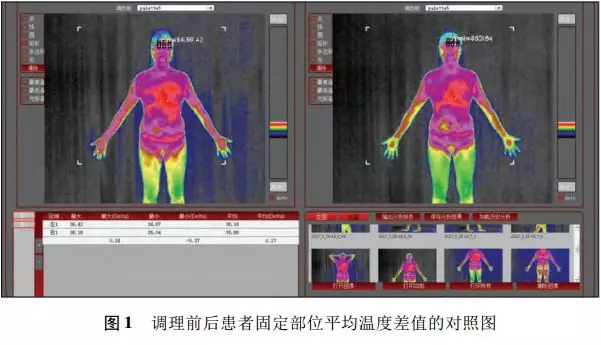 斷層成像技術(ttm)應用於患者康復調理》登入《世界中西醫雜誌》_中醫