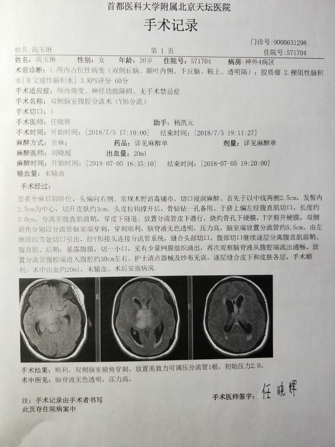 7月4日,玉琳转院到北京天坛医院,最终诊断为恶性神经胶质瘤,而这时,她