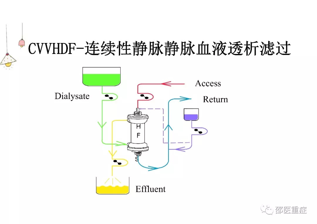 血液净化治疗的理论基础及常用模式快来学习吧