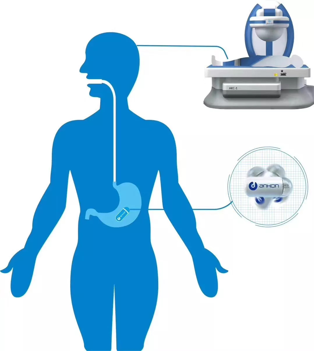 电子磁控胶囊胃镜小小机器人为您的胃肠保驾护航