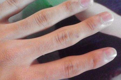 女生手指关节粗命运图片