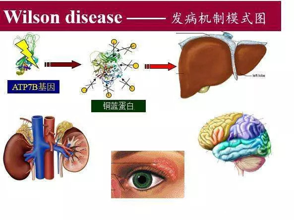 眼睛kf环图片