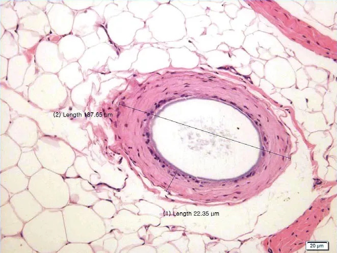 毛细血管显微镜图片图片