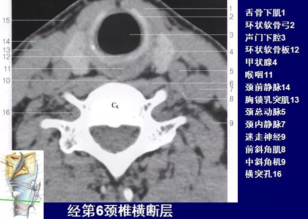 咽部 断层解剖图片