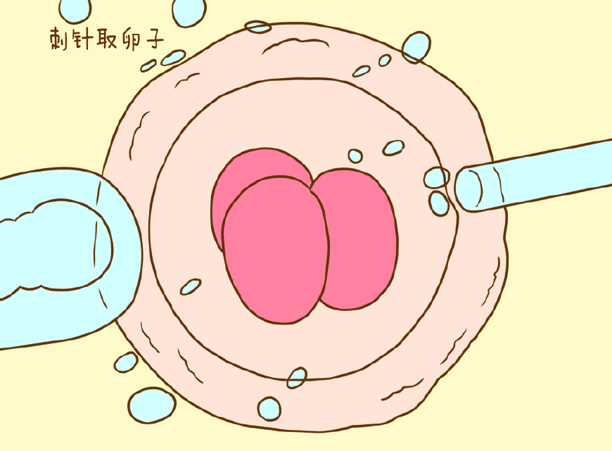 做试管婴儿心态重要吗(做试管婴儿心态重要吗女性)-第2张图片-鲸幼网