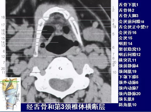 口咽部ct解剖图图片