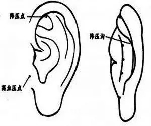 耳朵上的降压沟图示图片