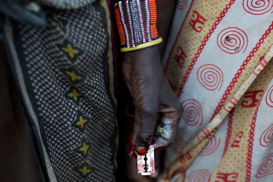 非洲女孩割礼割哪里图片