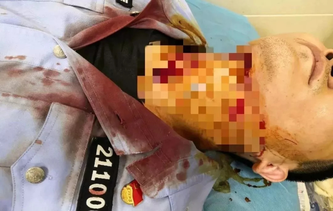 丹东警察被割喉图片图片