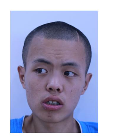 急寻线索:北京海淀20岁小伙急寻家属,患智力障碍,高1米78
