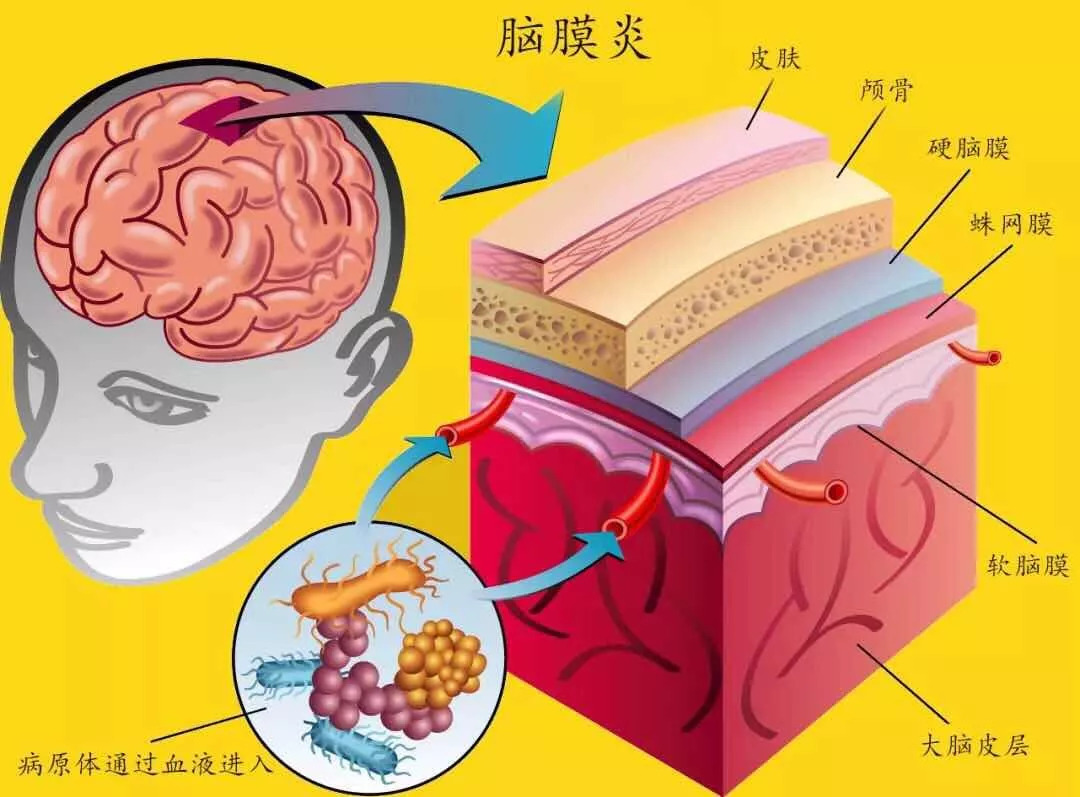 腦炎&腦膜炎,和你想的不一樣