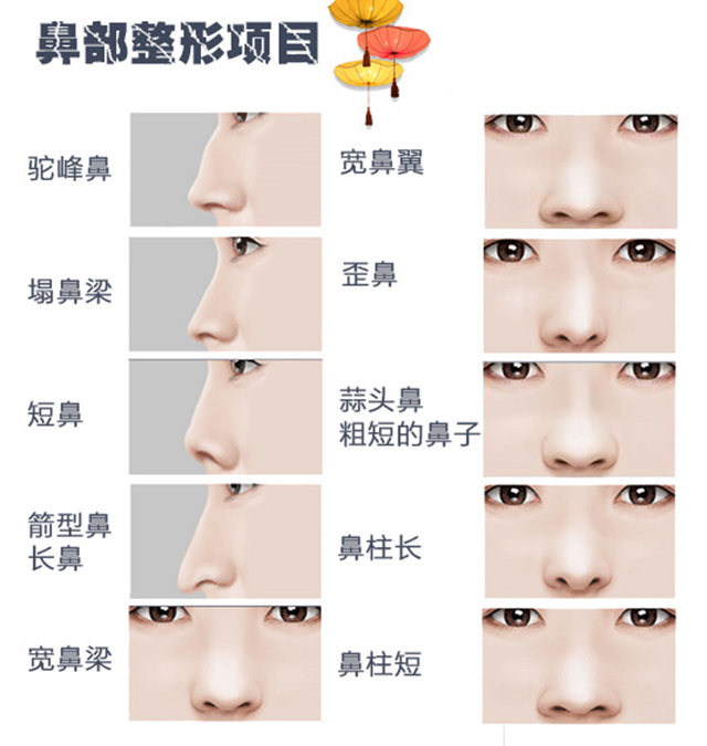 鼻子类型图片图片