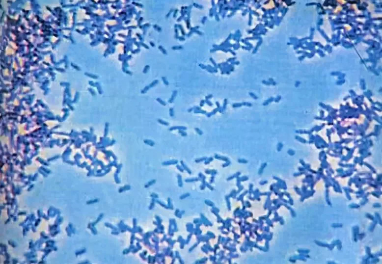 大肠杆菌显微镜油镜图片