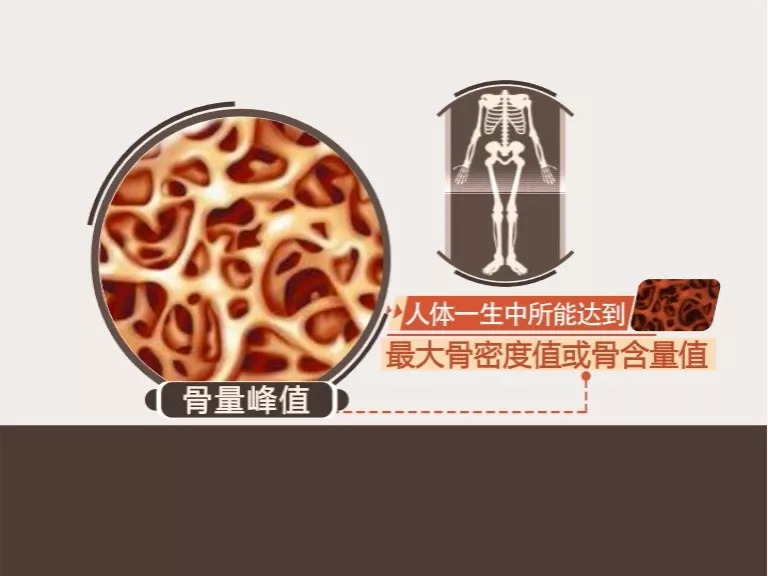 骨质疏松从小预防才管用来看看如何积累人体骨量