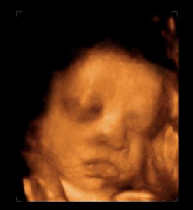 21周胎儿四维彩超图图片
