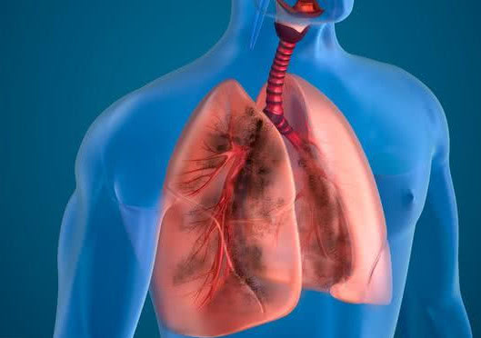 肺癌疼痛点的位置图图片