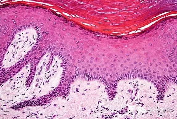圖中顯示的是人類皮膚細胞,圖中頂部兩個深粉色組織層構成表皮,這種