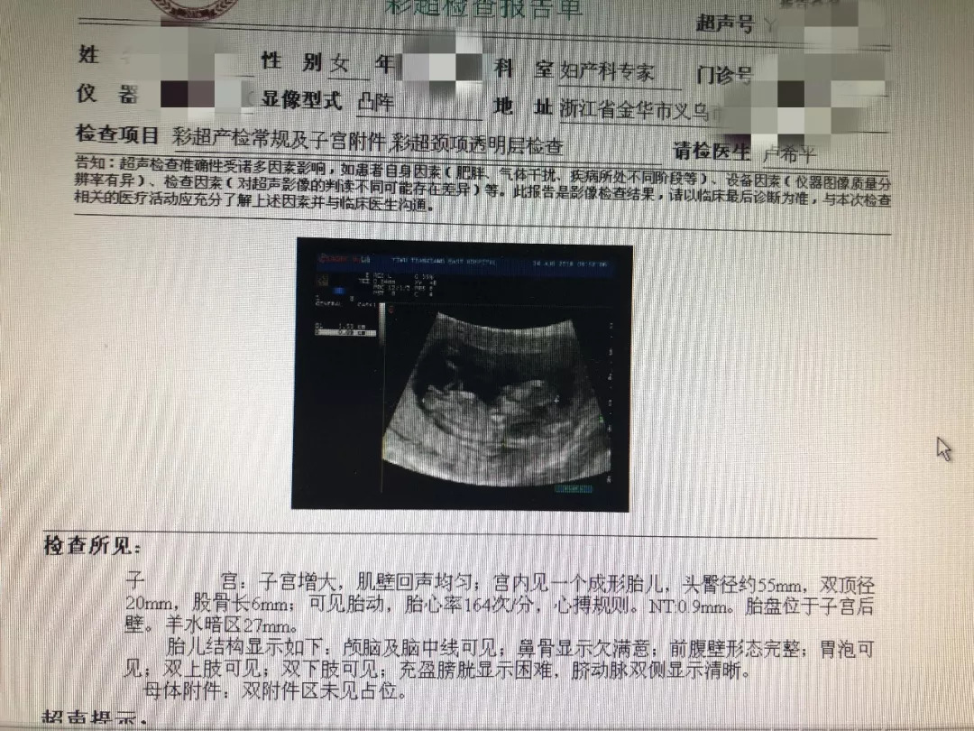 3孕早期流產因素多,應積極保胎婦科主任張霞說,女性在懷孕初期的前三